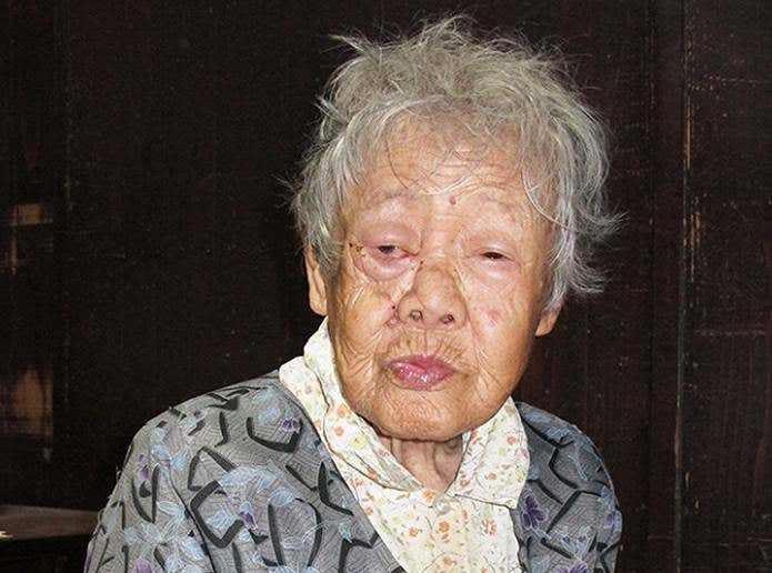 クマ：多賀・被害１年重傷負った田中さん