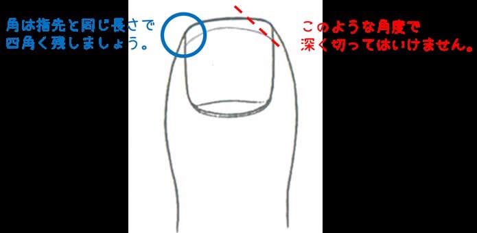爪のきりかた