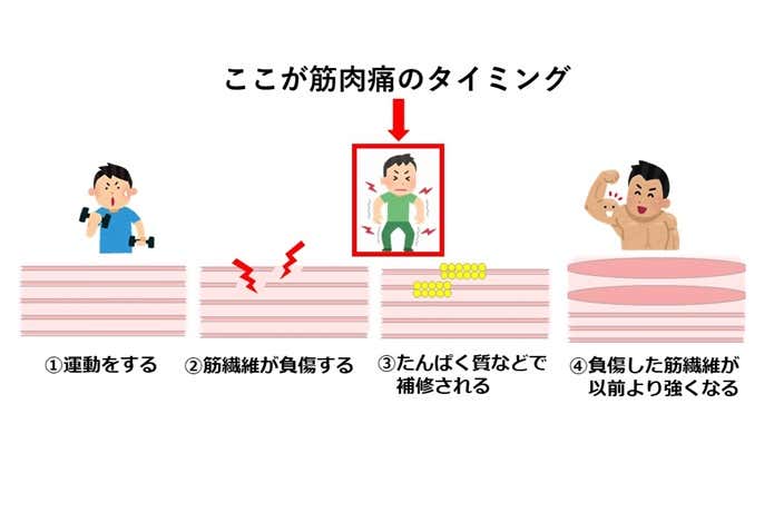 筋肉痛のメカニズム