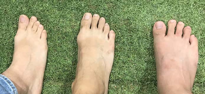足型はさまざま
