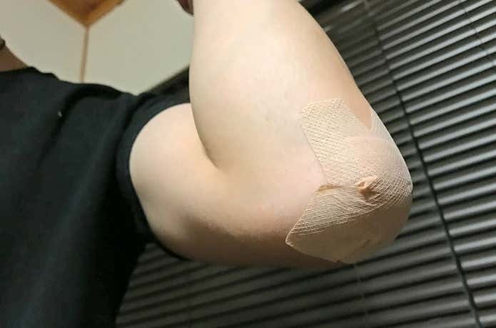 ひじに絆創膏を貼る