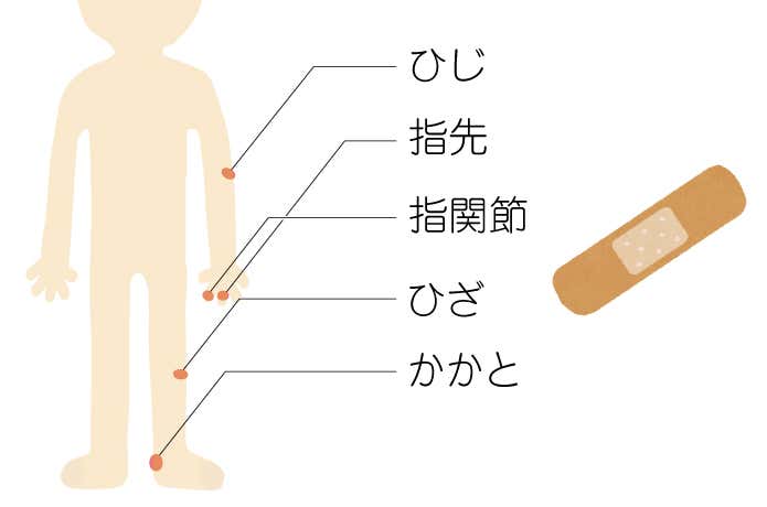 コレクション 傷 テープ 貼り 方