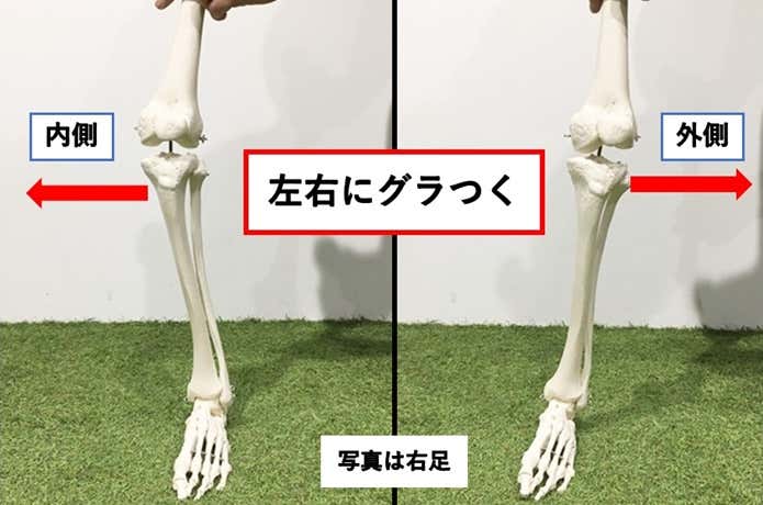 膝のぐらつき