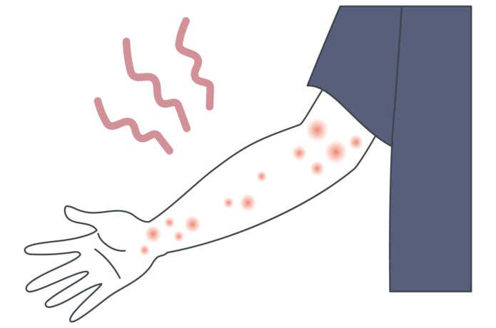 虫刺されイメージ