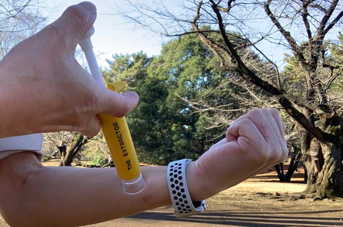 ポイズンリムーバーでの吸い出し