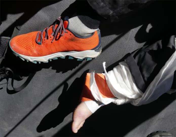 ローカットシューズに多い足首の負傷