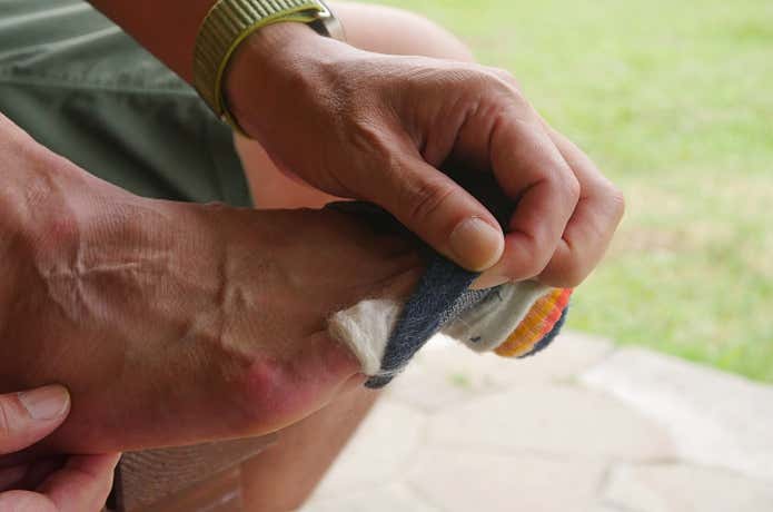 BLISTER WOOL