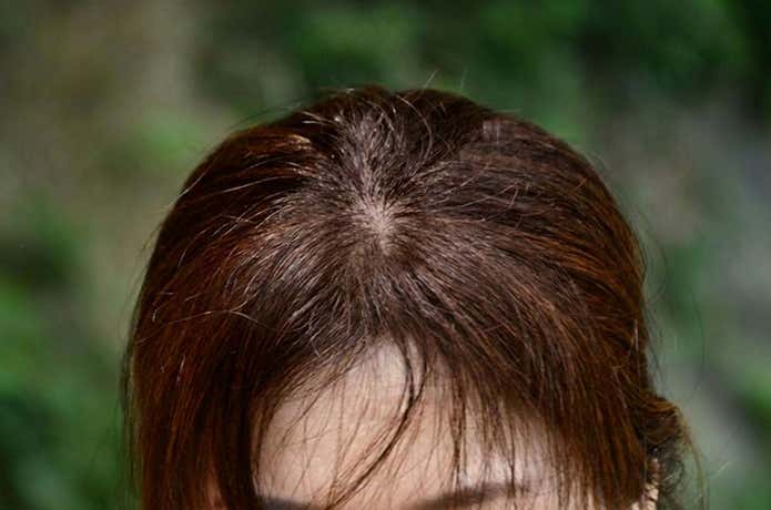 登山後、帽子を脱いだ後前髪がボサボサになっている状態